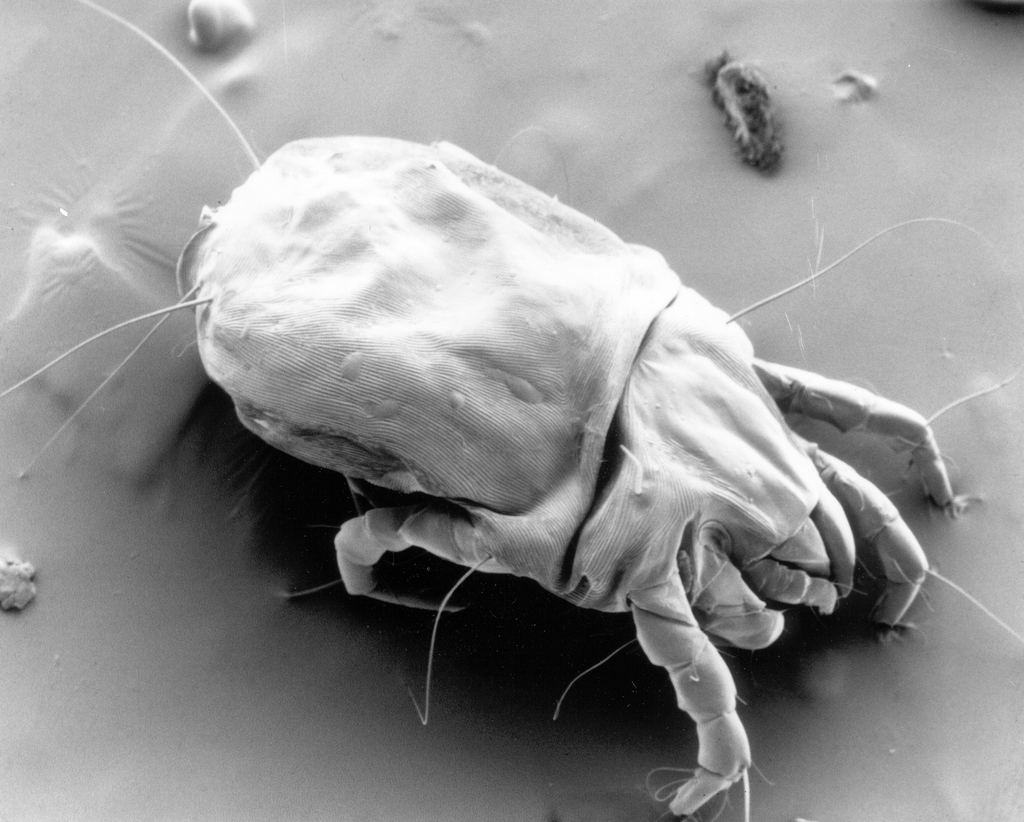 mite-picture-from-wikipedia